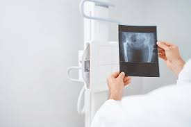 Meningkatkan Kemampuan Melalui Tryout Online Simulasi Radiografer